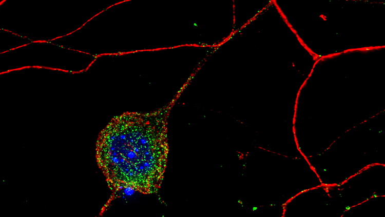 dorsal root ganglion neurons red blue and green