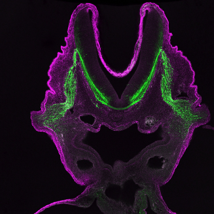 cranial ganglion purple and green