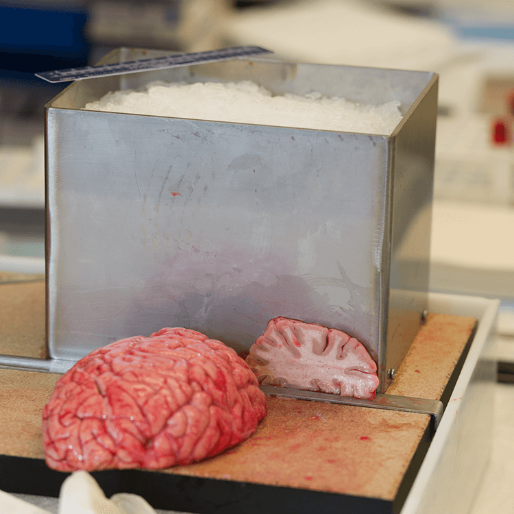 Sliced human brain