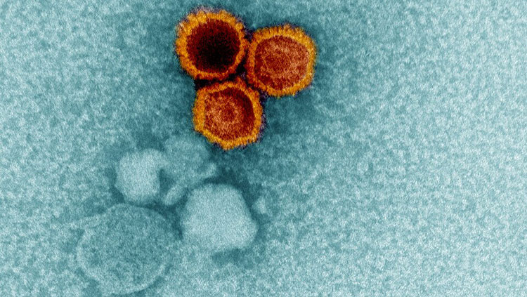 Three colorized Epstein-Barr virus particles