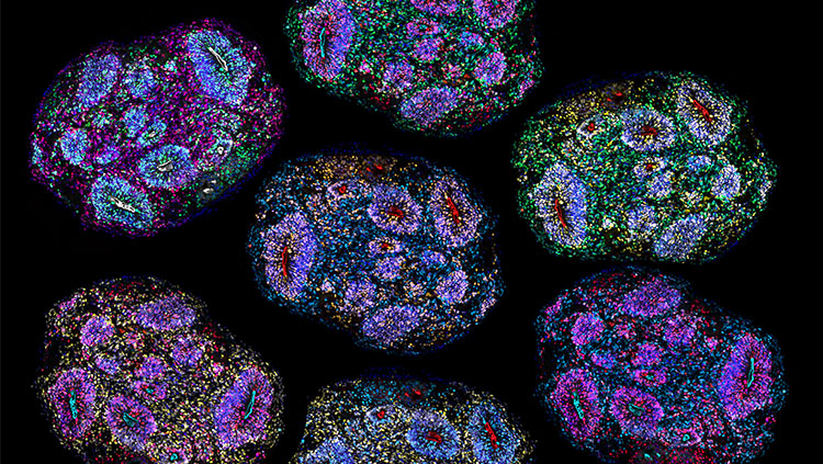 A brain organoid section