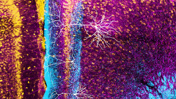 Image of neuron