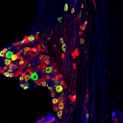 Heterogeneity of neuronal cell bodies of sensory nerves within the vagal ganglia.