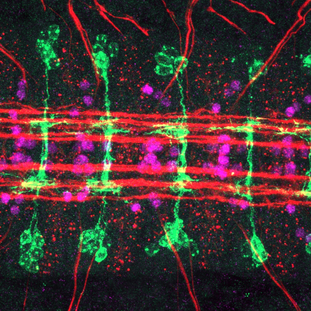 magnified image of the developing central nervous system in a Drosophila embryo