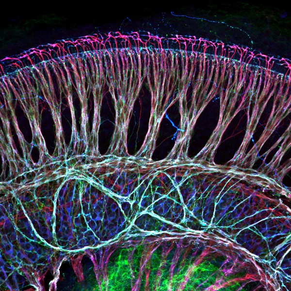 an immunostained whole-mount preparation of a mouse cochlea