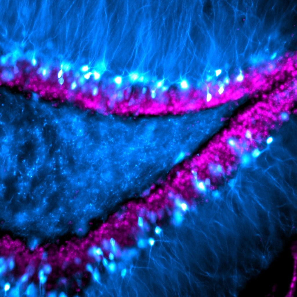 eN SiN dentate gyrus granule cells