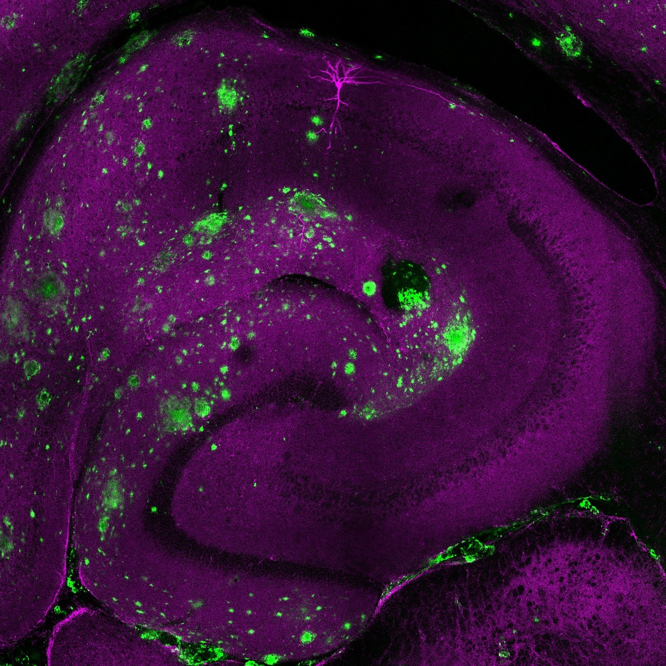 eN SiN neurotoxic plaques