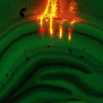 eN SiN rat dorsal hippocampus