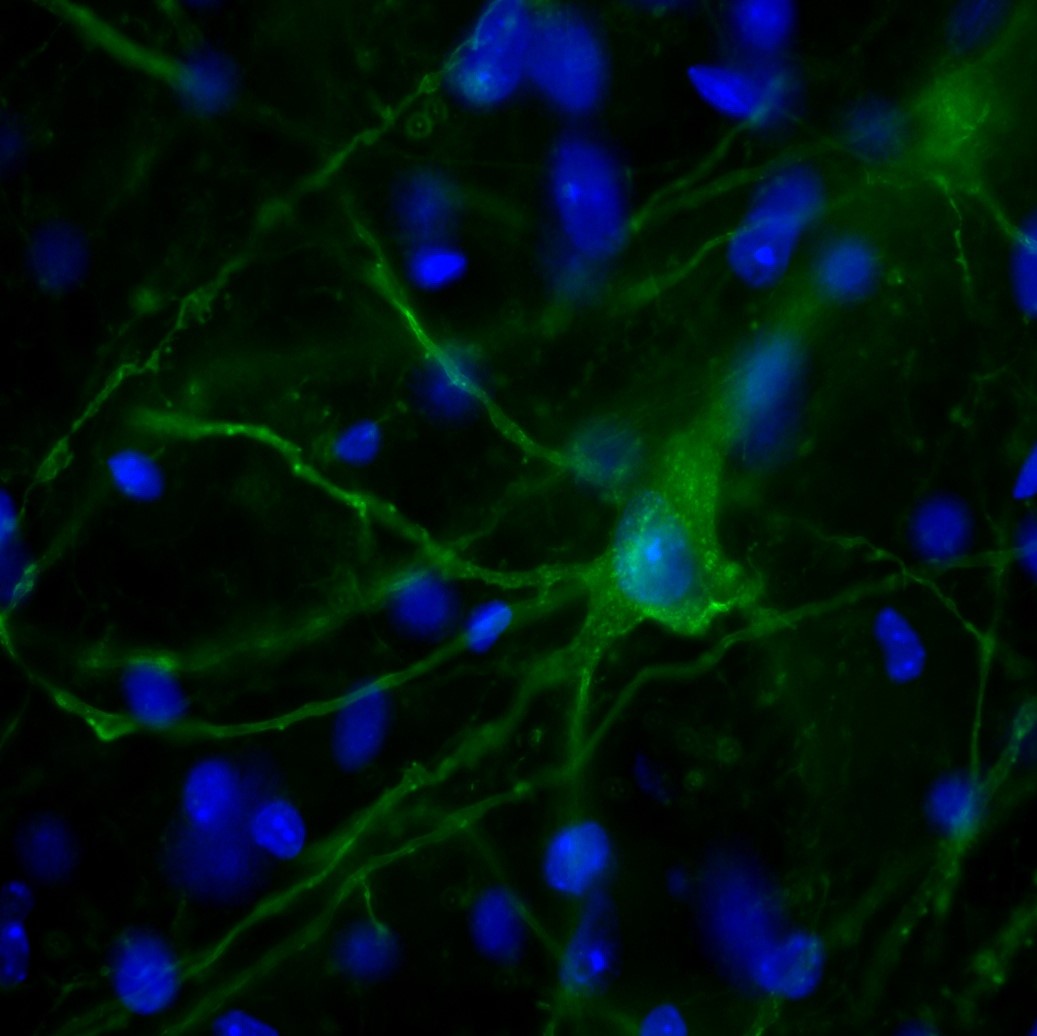 A confocal image showing a neuron, likely a fusiform cell, at the dorsal cochlear nucleus of a coronal slice from a mouse 