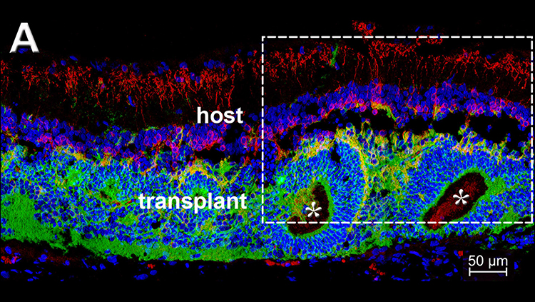 Cell Transplant Restores Vision in Rats