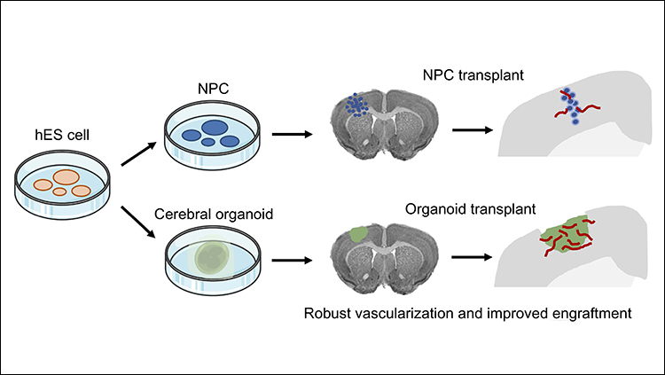 Better Way to Transplant Human Stem Cells