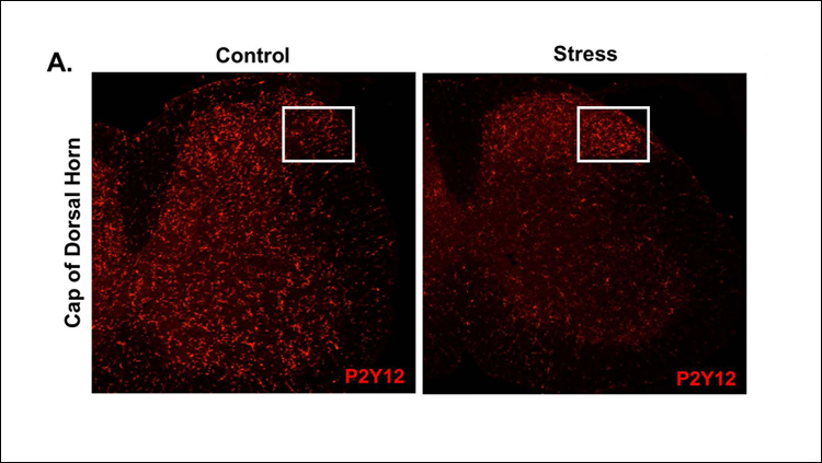 Microglia Transmit Pain to the Brain During Stress