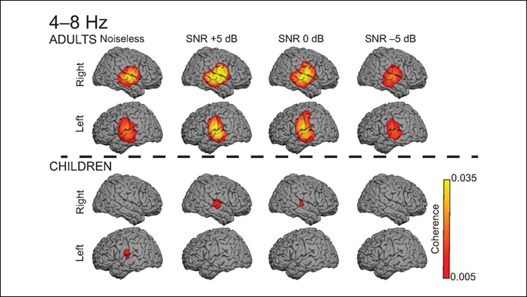 Why Children Struggle to Understand Speech in Noisy Backgrounds
