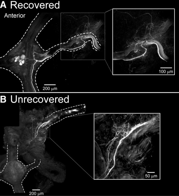 Figure 1. Leeches that recover crawling behavior have established regrowth of afferent input to the lead ganglion. (A) In leeches that recover crawling behavior after injury, Neurobiotin labels fibers in the M3 nerve, which project into the M3 ganglion. (B) In leeches that do not recover crawling behavior after injury, Neurobiotin-labeled fibers are not observed in the M3 ganglion. (Figure 8 in Puhl et al. 2018.)