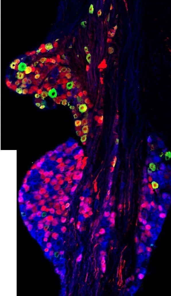 image of the neuronal cell bodies of sensory nerves within the vagal ganglia, just outside the brainstem. 