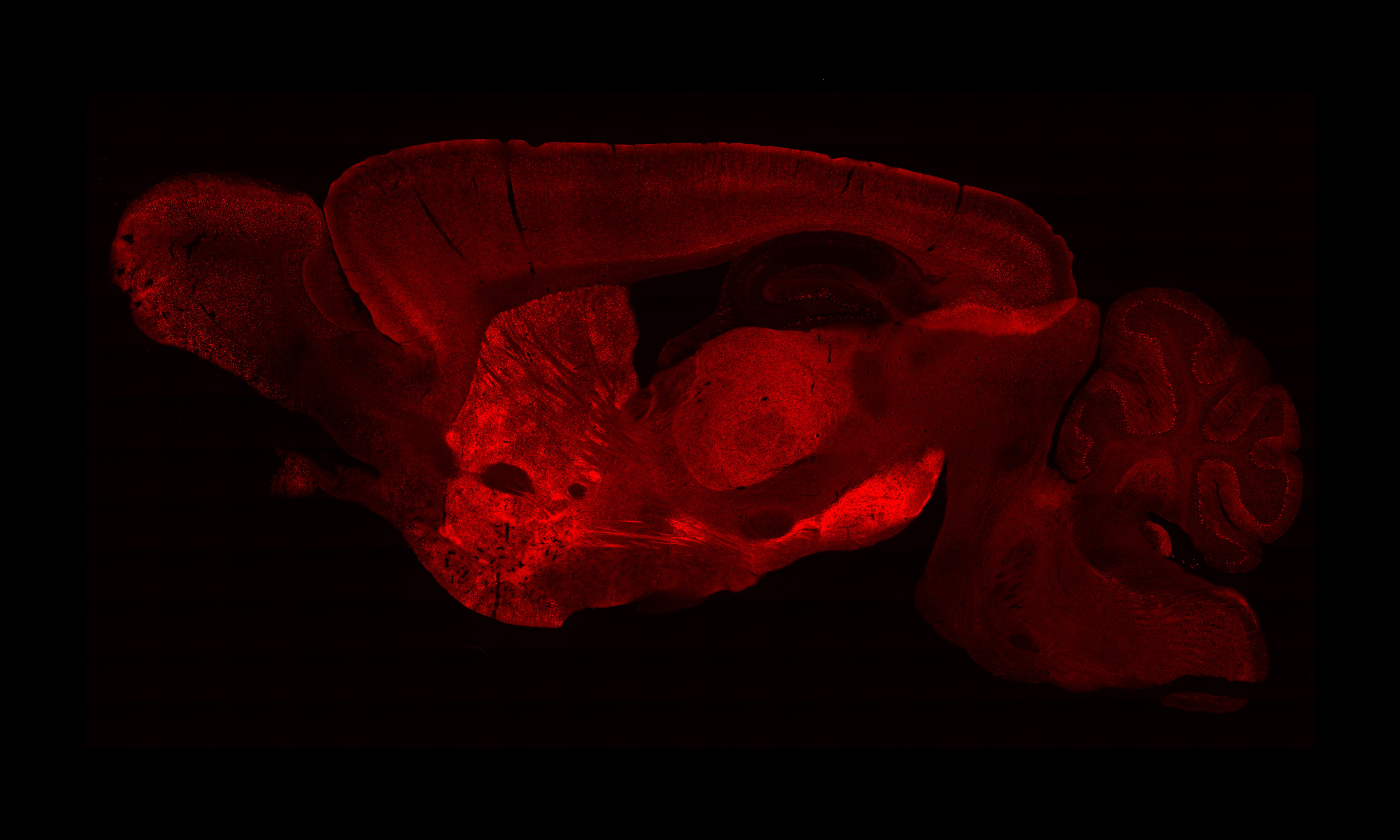 Image of neurons responding to medicinal and abused opioids in the mouse brain