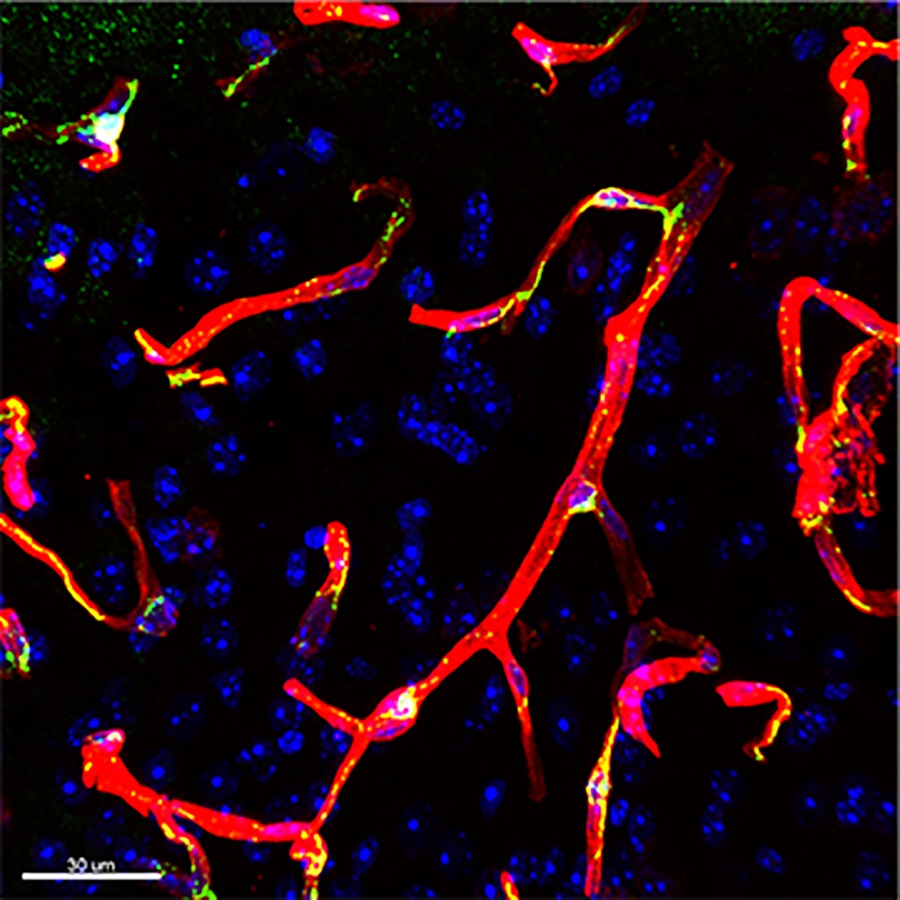 Image of blood vessels from region of the parietal cortex in mouse brain