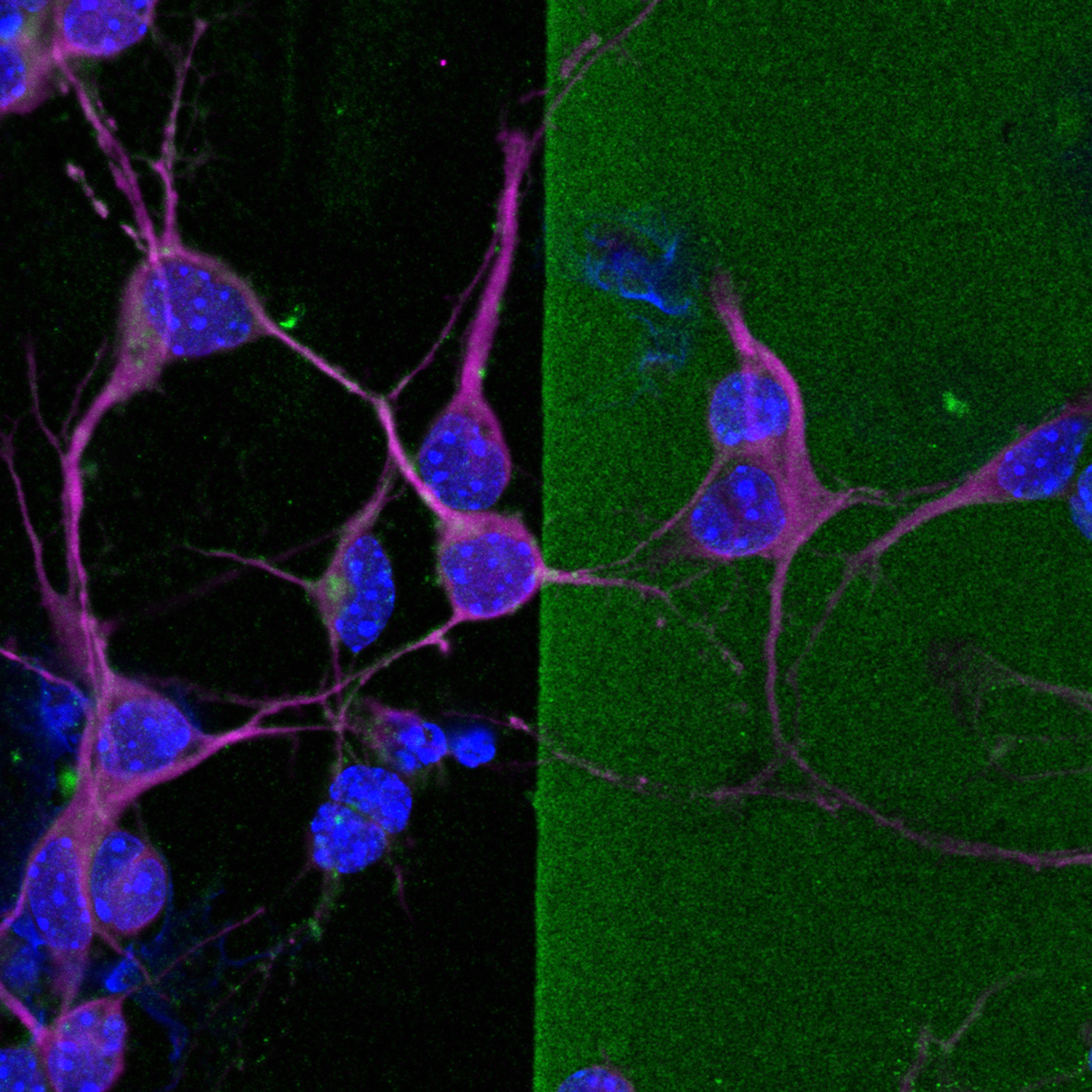 MAP2+ (magenta) neurites from cultured immature cortical neurons extending into a stripe of chondroitin sulfate proteoglycans (CSPGs; green) treated with chondroitinase ABC (chABC), an enzyme that abolishes CSPGs