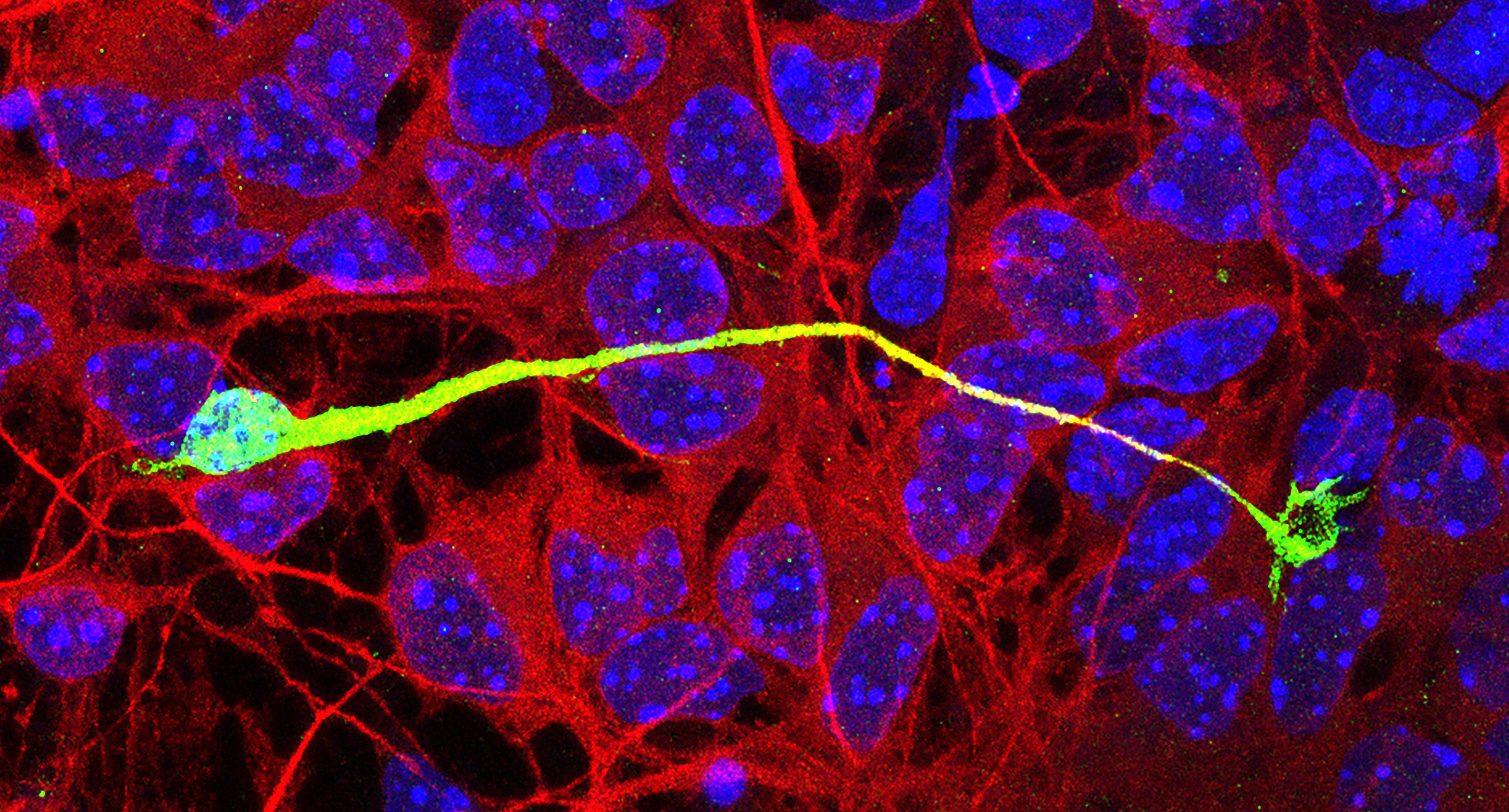 an interneuron migrating on a monolayer of cortical feeder cells in an in vitro co-culture assay.